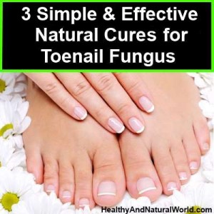 3 Simple and Effective Natural Cures for Toenail Fungus