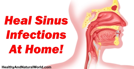 Can i take amoxicillin for a sinus infection – Jeff's ...