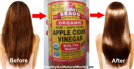 Apple Cider Vinegar Benefits Weight Loss Reviews