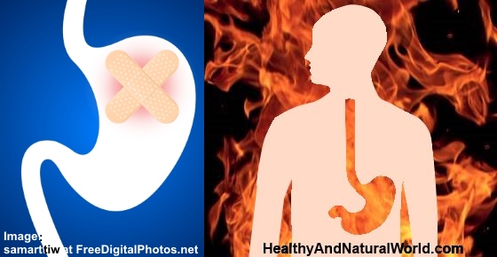 12 Effective Natural Treatments for Heartburn and Stomach Ulcers