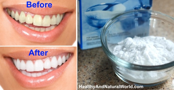 13 Natural Methods for Teeth Whitening