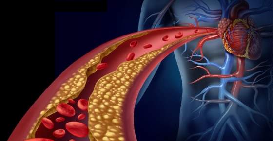 10 Simple and Effective Ways to Lower Cholesterol Naturally