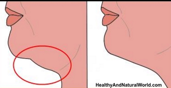 Exercises and Other Natural Ways to Get Rid of Double Chin