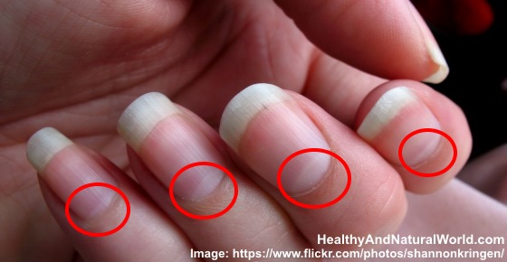 11 Health Warnings Your Fingernails May Be Sending