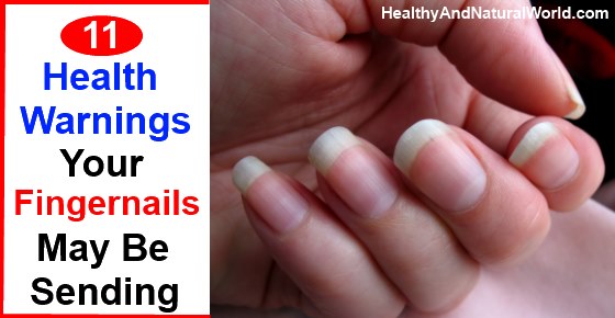 11 Health Warnings Your Fingernails May Be Sending