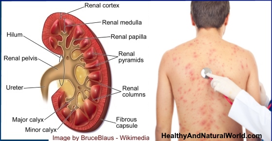 Early Signs of Kidney Disease & How to Protect Your Kidneys