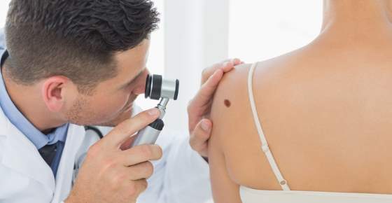Warning Signs of Melanoma, The Most Deadly Form Of Skin Cancer