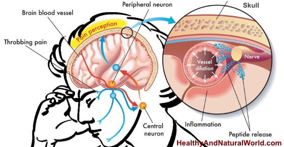 Top 15 Causes of Headaches and How to Get Rid of Them Naturally