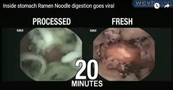 Shocking Video Reveals What Happens Inside Your Stomach When You Eat
