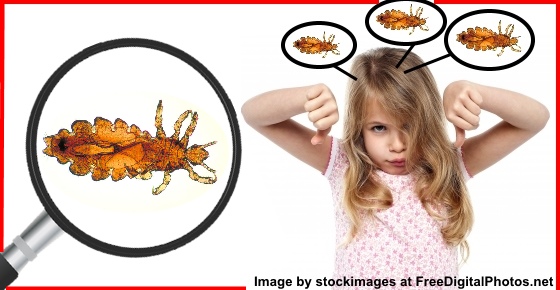 Eliminate Head Lice With This Simple Home Remedy