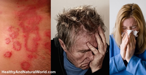 Adrenal Burnout - Causes, Symptoms and Natural Cures