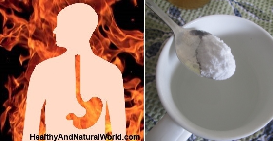 How to Use Baking Soda to Treat and Prevent Acid Reflux