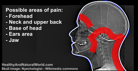 This Common Nutritional Deficiency Can Cause Migraine Headaches