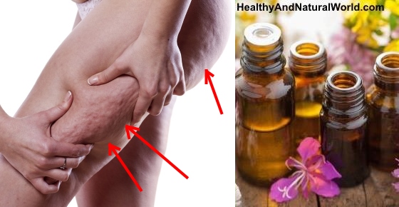 The Best Essential Oils for Treating Cellulite