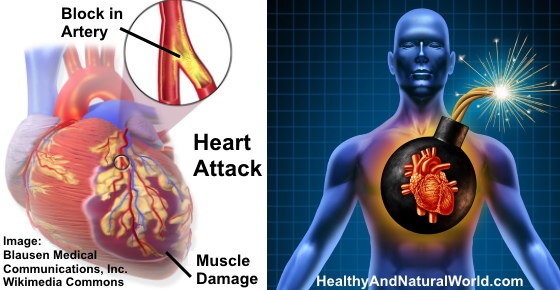 80% of Heart Attacks Could Be Avoided by Doing These 5 Easy Things