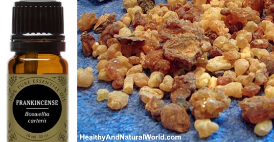 Frankincense Essential Oil Uses and Benefits
