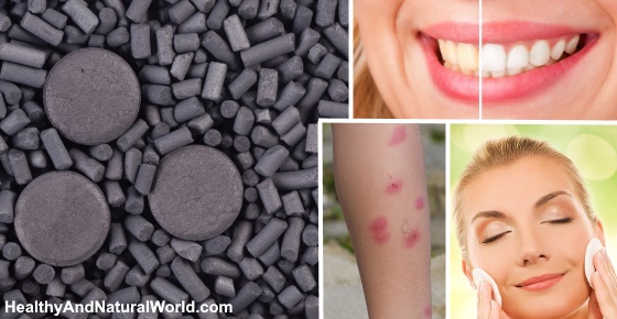 Activated Charcoal Benefits and Uses