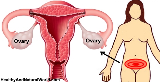 Ovary Pain