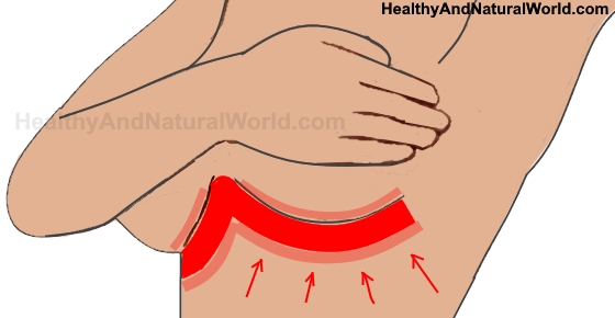 red rash under breasts