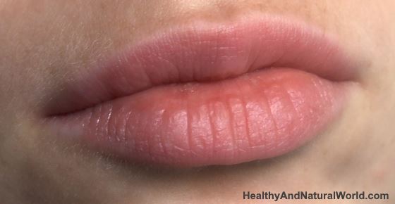 On very lips bumps tiny Causes of