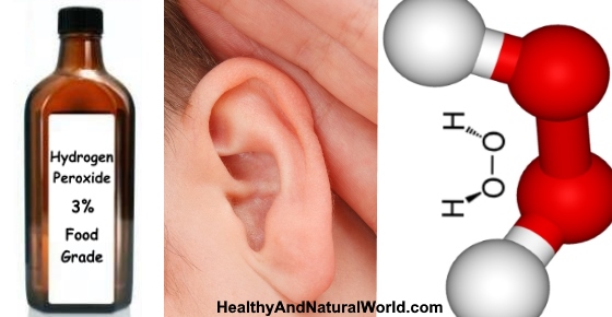 Hydrogen Peroxide In Ear For Ear Wax Removal And Ear Infection
