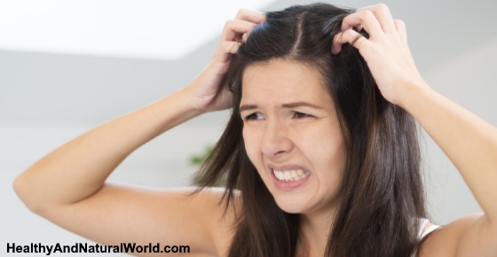 The Best Home Remedies for Dry and Itchy Scalp