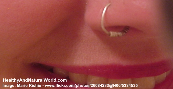 Bump on Nose Piercing - Natural Treatments for Infected Piercing