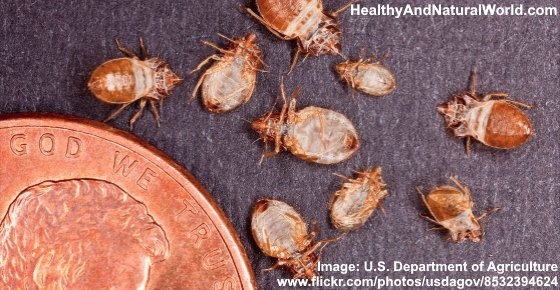 10 Home Remedies to Get Rid of Bed Bugs Naturally