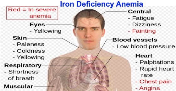 Top Signs of Iron Deficiency and How To Increase Iron Levels In Your Blood
