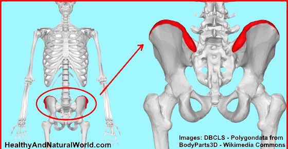 Iliac Crest Pain - Causes and Home Remedies