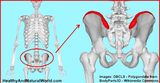 Iliac Crest Pain: Causes and Home Remedies