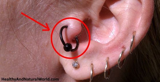 Sale > my tragus piercing is swollen > in stock