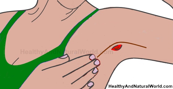 Cyst in Armpit - Causes, Treatments And When To See a Doctor