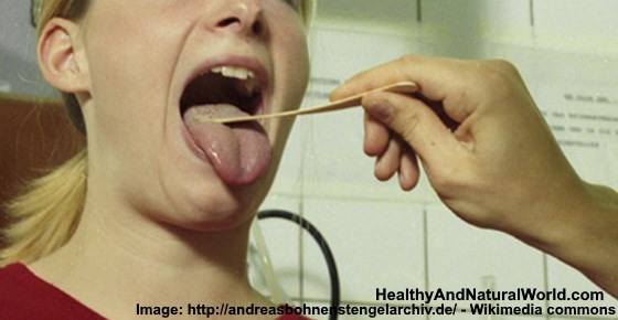 Bumps on Back of Tongue: Causes and Effective Treatments