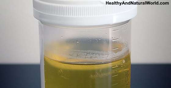 White Stuff or Particles in Urine: What It Means and What ...