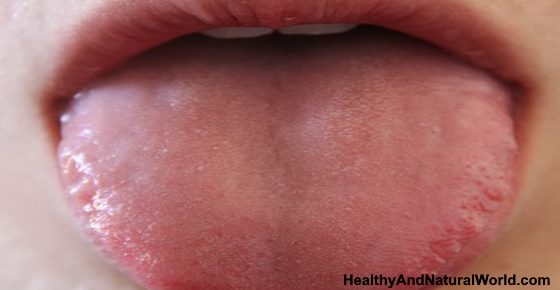 Black Spots On Tongue Causes Treatments And When To See A Doctor