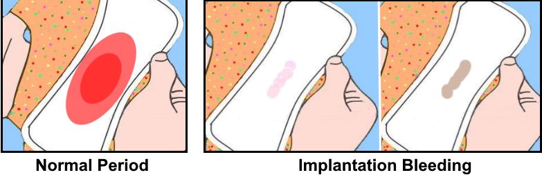 implantation bleeding vs period images