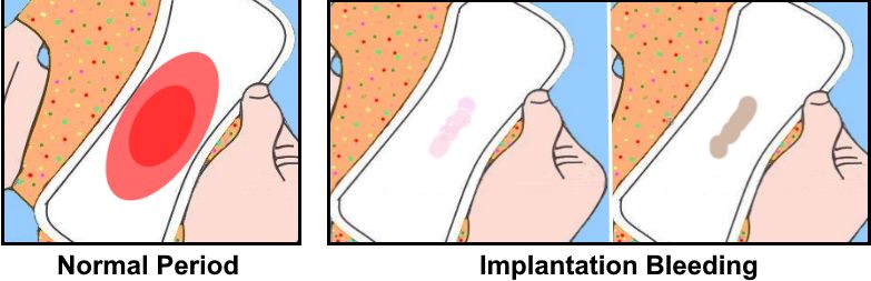 14 Signs of Implantation or Early Pregnancy Before Missed ...