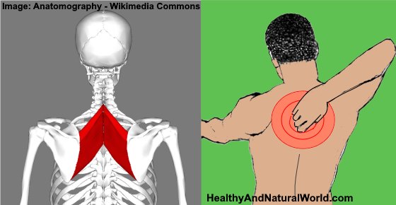 Rhomboid Muscle Pain: Causes, Treatments and Prevention