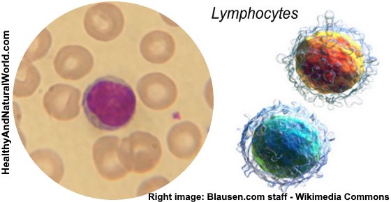 Low Lymphocyte Count (Lymphocytopenia) - What Does It Mean?