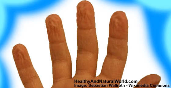 Pruney fingers: Causes, Treatments and When to See a Doctor