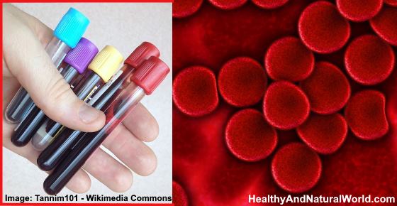MPV Blood Test: What It Means and What It Tells About Your Health