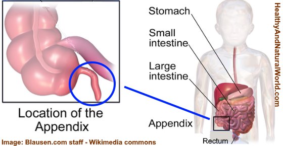 Appendix: Location, Function, Pain, and Symptoms of Appendicitis