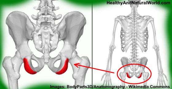 Sit Bone Pain