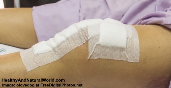 Common Types of Wound Drainage and How to Take Care of Your Wound