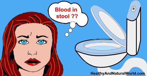 Bloody Stool (Pooping Blood): What it Means and When to See a Doctor