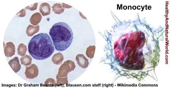 High or Low Monocytes in Blood Test - What Does It Mean?