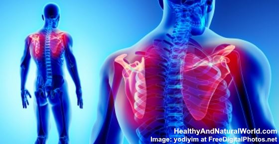 Pinched Nerve in Shoulder: Symptoms, Causes, and Effective Treatments