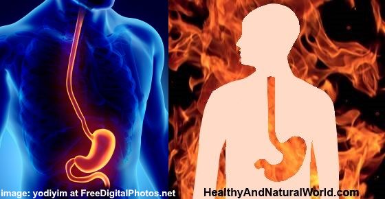 How to get rid of Heartburn (Acid Reflux) & Natural Antacids