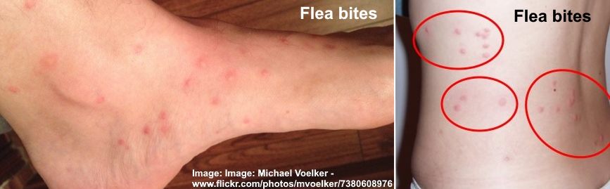 flea bite images